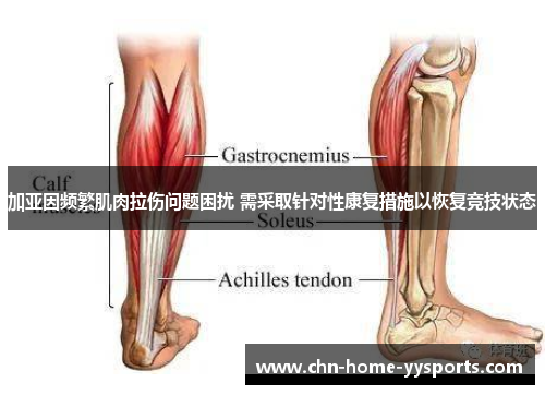 加亚因频繁肌肉拉伤问题困扰 需采取针对性康复措施以恢复竞技状态